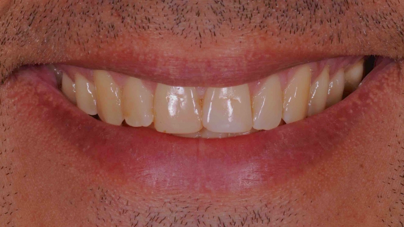 15883100901-dsc-2769jpg