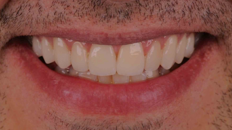 15883100901-dsc-2769jpg