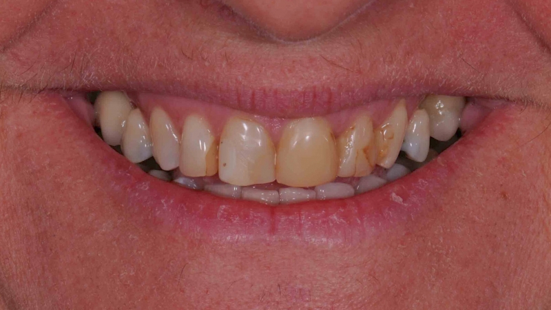 15883105181-dsc-5148jpg