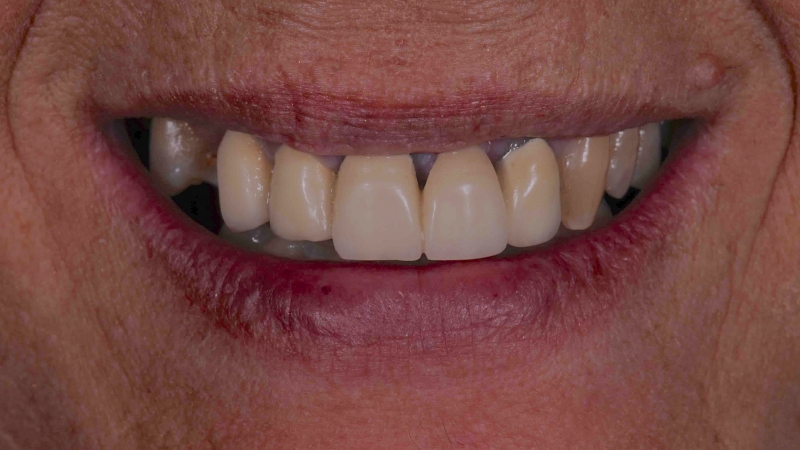 15883109661-dsc-7250jpg