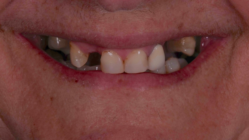 15883125081-dsc-8455jpg