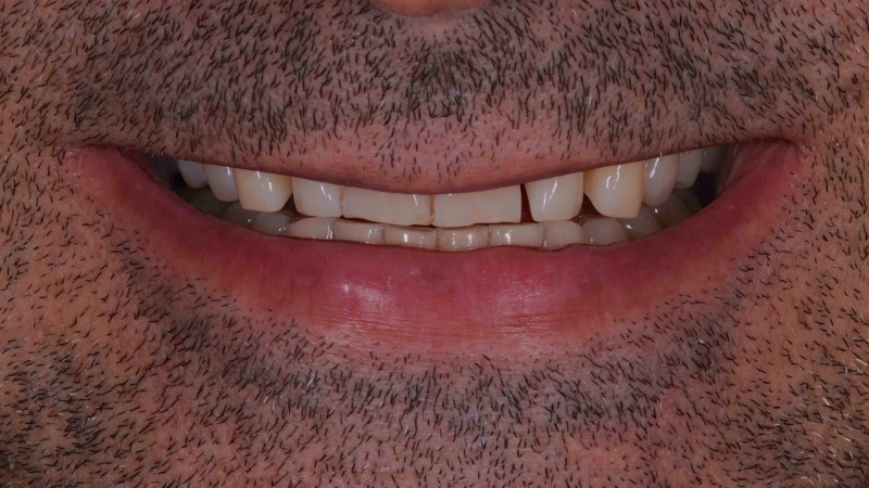 15883147451-dsc-8899jpg