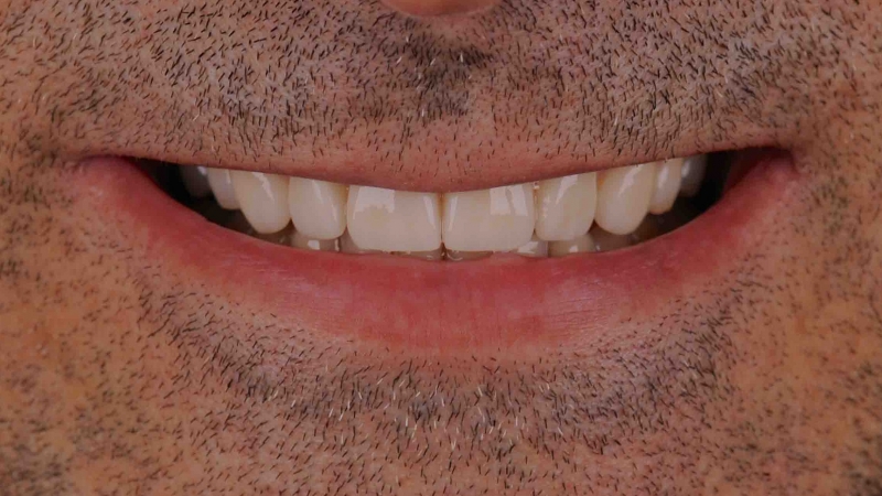 15883147451-dsc-8899jpg