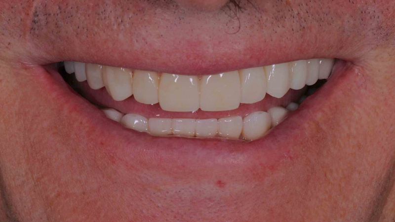 15883149631-dsc-9800jpg