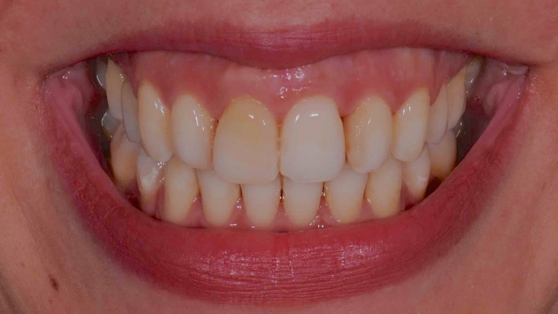 15883298651-dsc-1894jpg