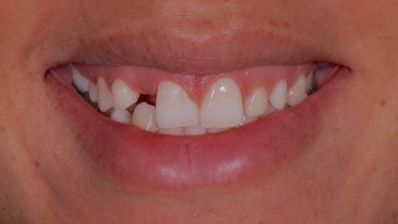 15883301381-dsc-2251jpg