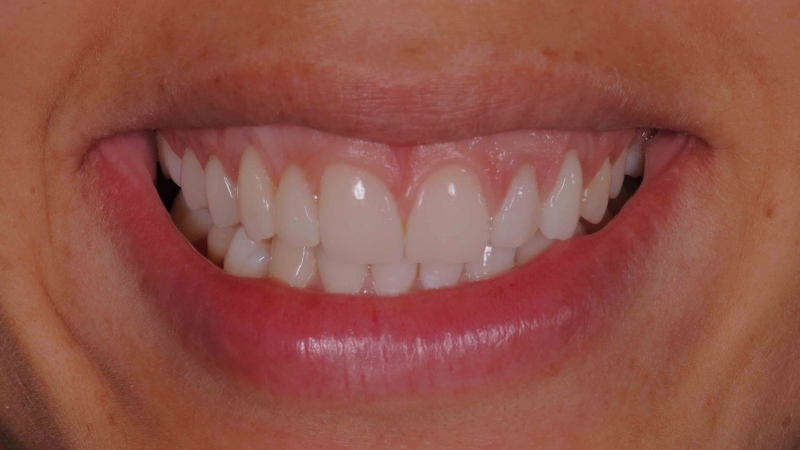 15883301381-dsc-2251jpg
