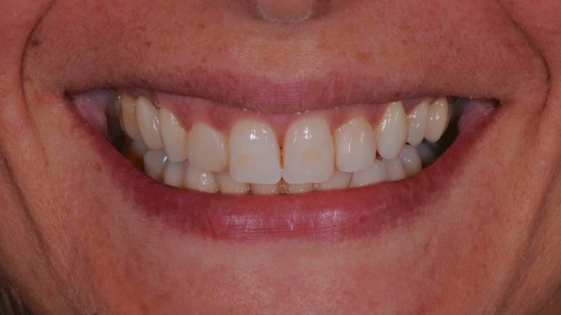 15883306061-dsc-3318jpg