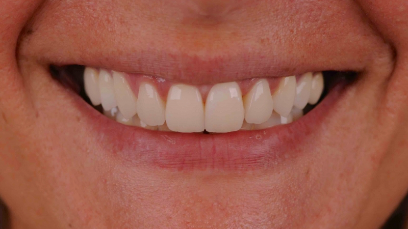 15883306061-dsc-3318jpg