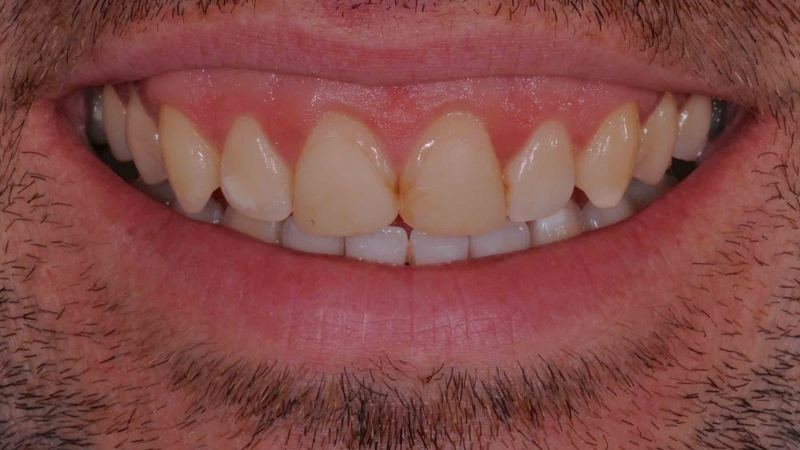 15883315441-dsc-4528jpg