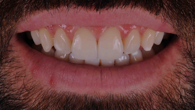 15883315441-dsc-4528jpg