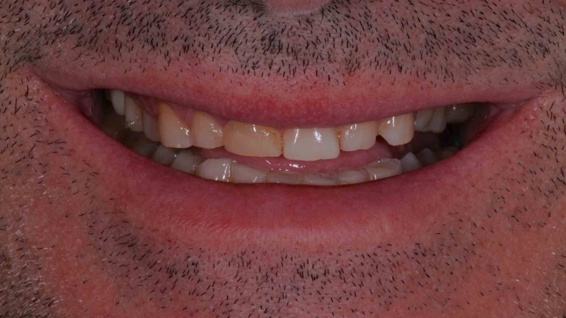 15883320651-dsc-4714jpg