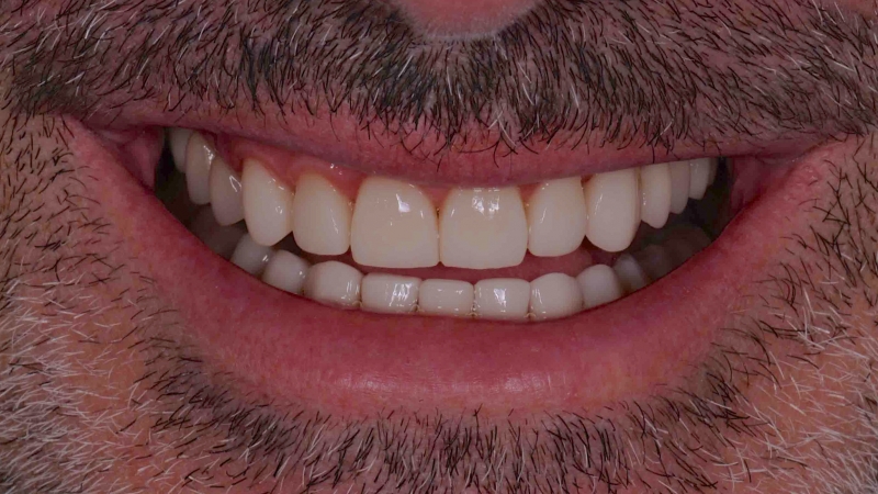 15883320651-dsc-4714jpg
