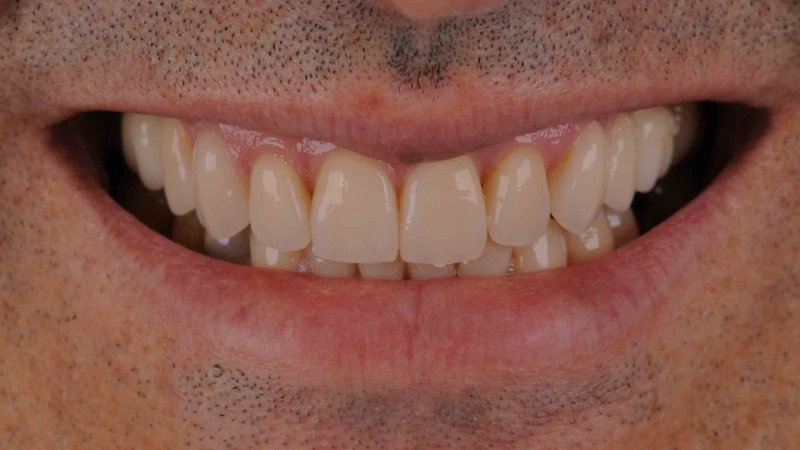 15883328281-dsc-6149jpg