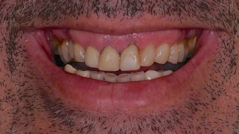 15883340961-dsc-6608jpg