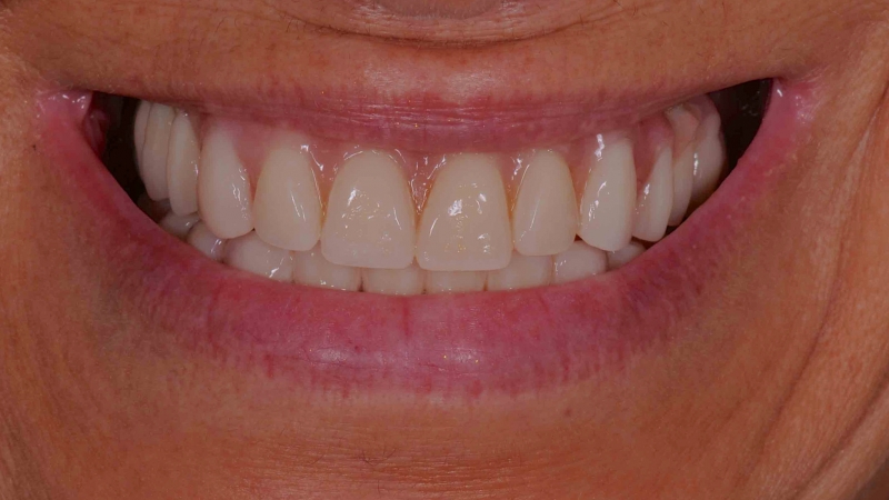 15883344451-dsc-0846jpg