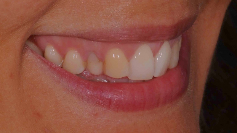 15883349331-dsc-2183jpg