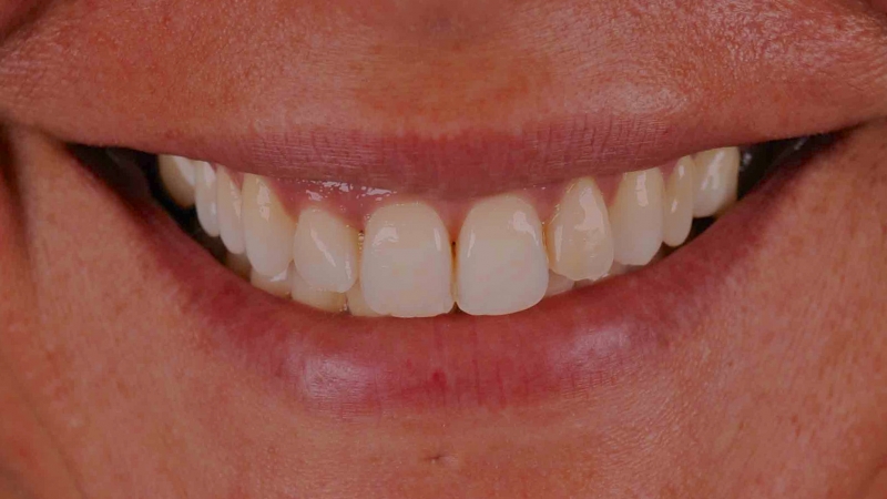 15883353371-dsc-6956jpg
