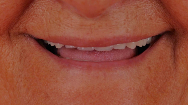 15883354911-dsc-7513jpg