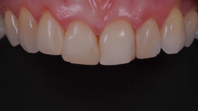 15883368001-dsc-7159jpg