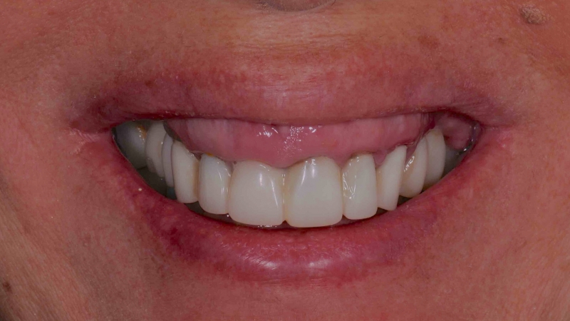 15883370671-dsc-0473jpg