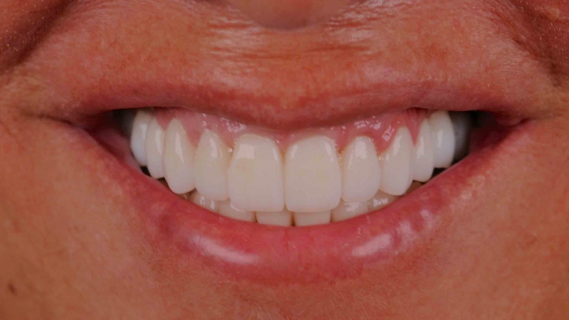 15883370671-dsc-0473jpg