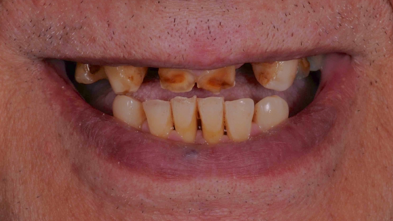 15883372861-dsc-1711jpg