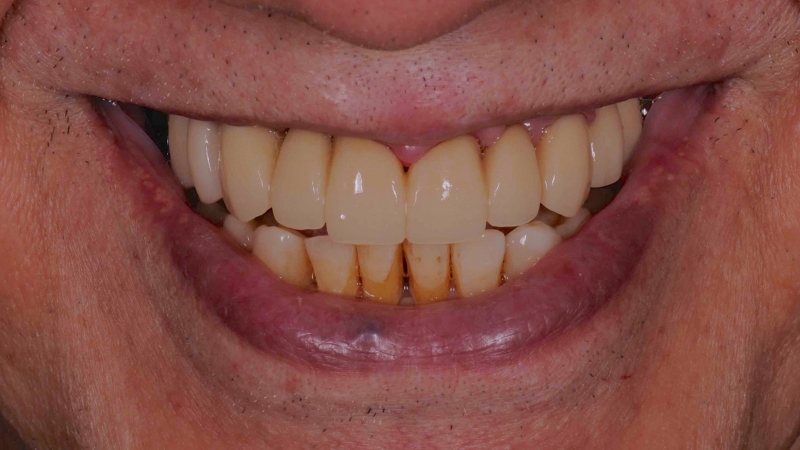 15883372861-dsc-1711jpg