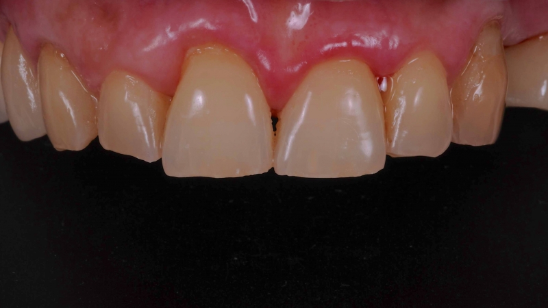 15883379131-dsc-3424jpg
