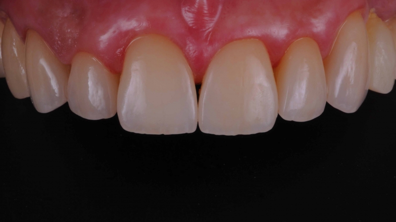15883379131-dsc-3424jpg