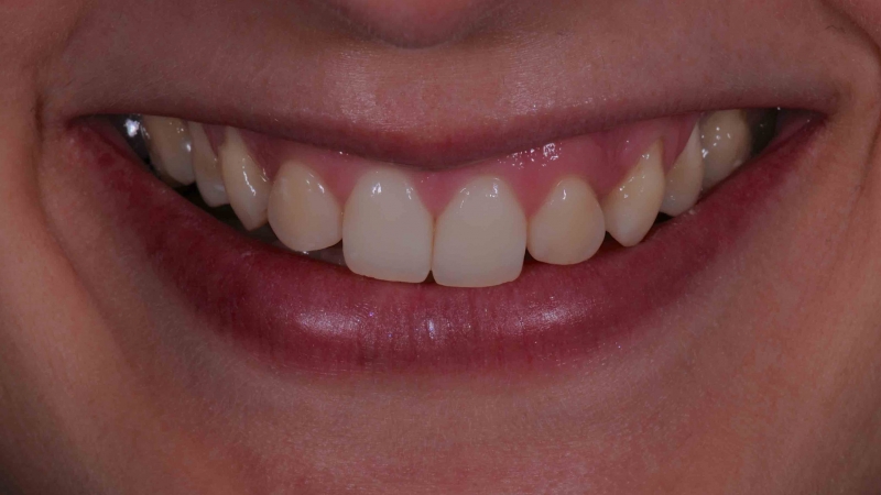 15883394651-dsc-7924jpg
