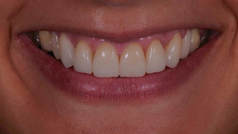 15883394651-dsc-7924jpg
