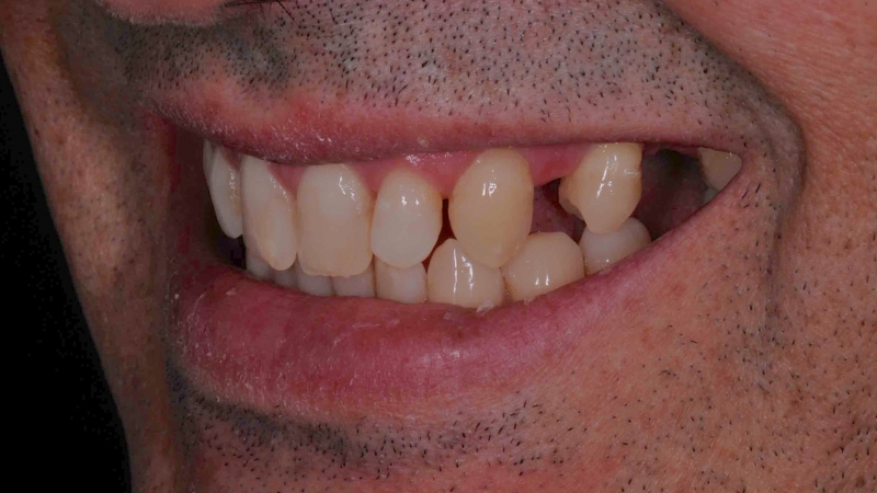 15883667121-dsc-6155jpg