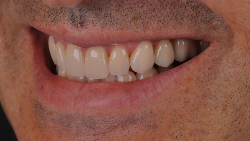 15883667121-dsc-6155jpg