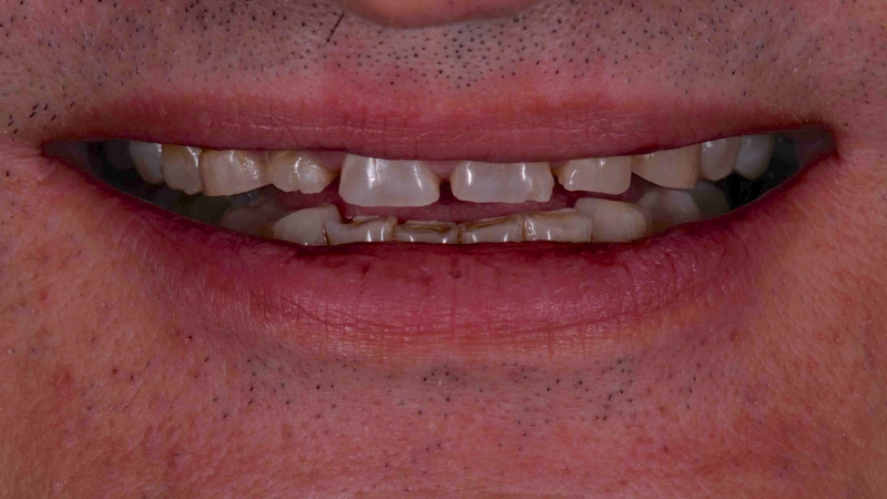 15883668801-dsc-5893jpg