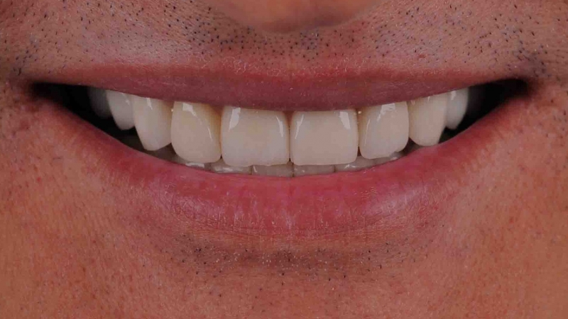 15883668801-dsc-5893jpg
