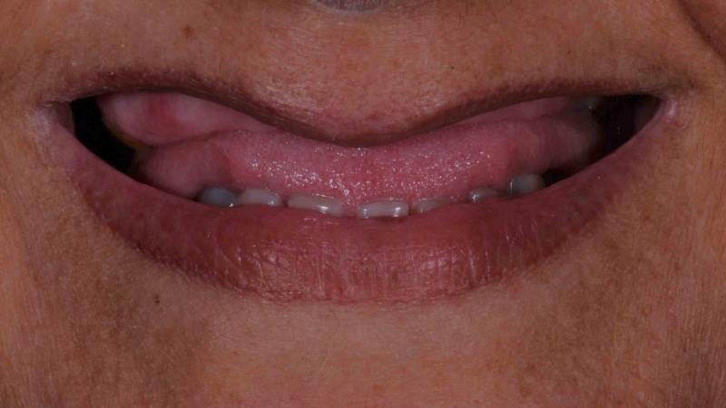 15883669301-dsc-8159jpg