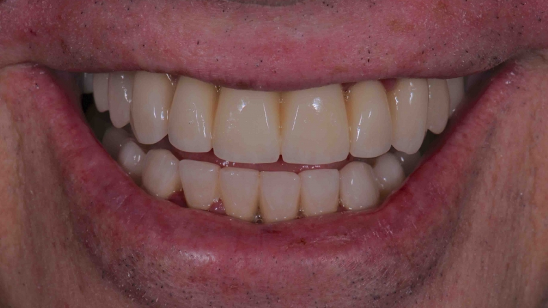 15883670861-dsc-0014jpg