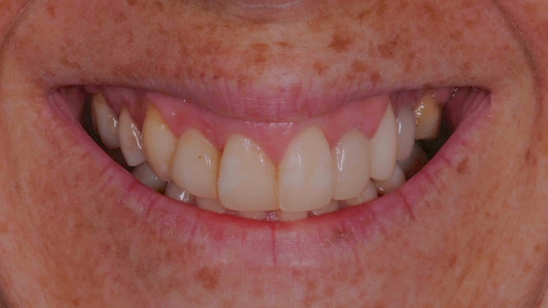 15883721081-dsc-1564jpg